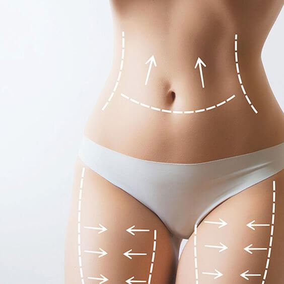 Sculpt Your Body with Liquid Lipo! The Key to a More Confident You at IVUSE in Atlanta, GA